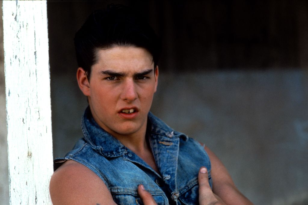 Tom Cruise 1983-ban, meglehetősen problémás fogsorral.
