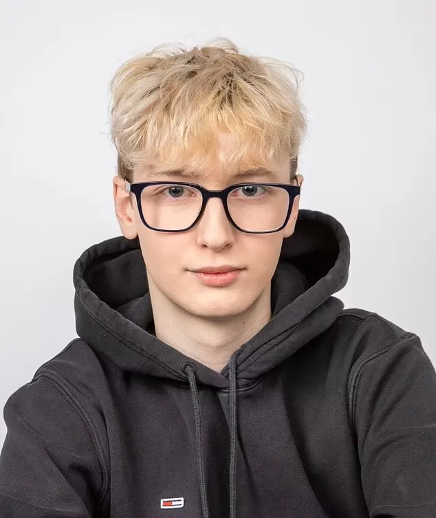 A fiatal influenszer szájfeltöltés miatt lett pikkelysömörös. 