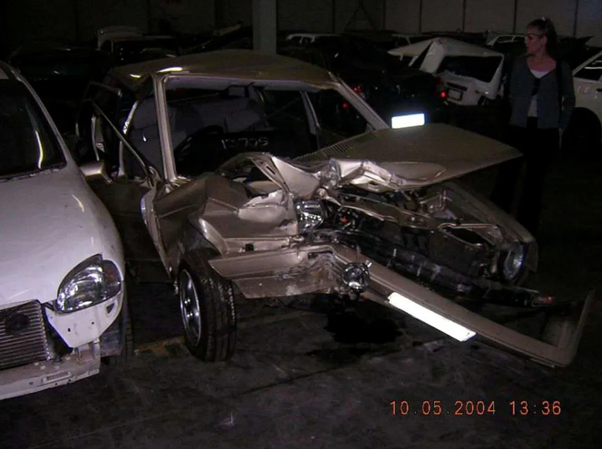 the car after the crash. A woman who had a facial reconstruction after car a crash has described how an infection saw her new prosthetic eating her face. Vanessa Carter, 47, was involved in a serious car accident in 2004 leaving her with life changing injuries. It included a broken jaw and nose, smashed cheekbones and loss of her right eye. Due to the traumatic collision, Vanessa from Torbay, Devon had to have her face reconstructed and an artificial eye made for her. She went through several surgeries to remove tissue from the damaged and infected areas and was placed on heavy doses of antibiotics. But after a prosthetic implant was placed to bridge a gap between her cheekbone and nose, she looked in her car’s rearview mirror and saw pus leaking from the cheek where the prosthetic had been inserted. She was told she had an infection which kept coming back and eat away the skin from the side of her face, leaving her terrified as her skin became thinner and weaker each day.
Photo released 28/12/2025