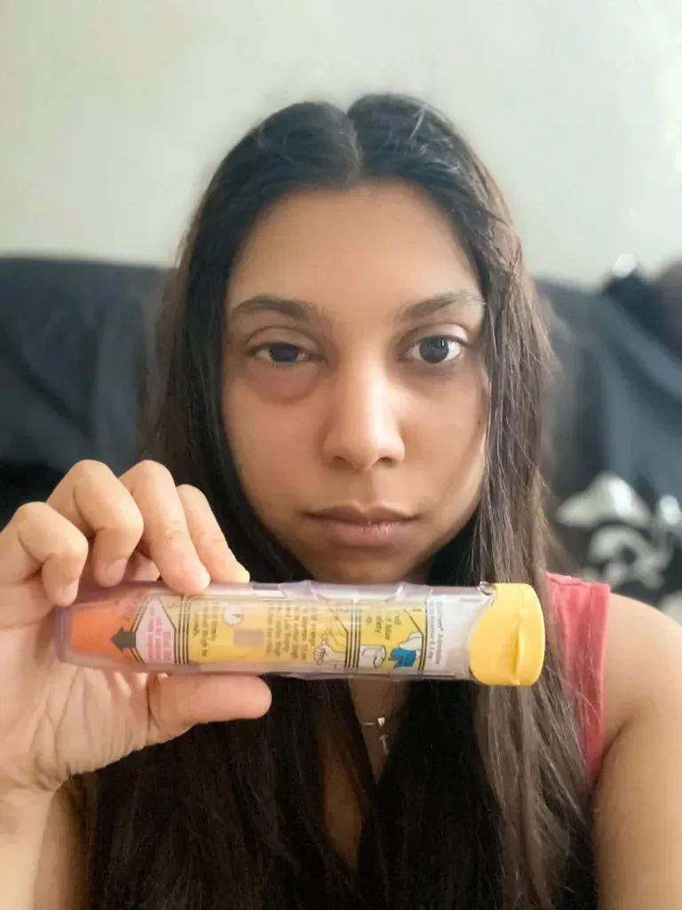 Julianne gyermekkora óta súlyos allergiás rohamokkal küzd.