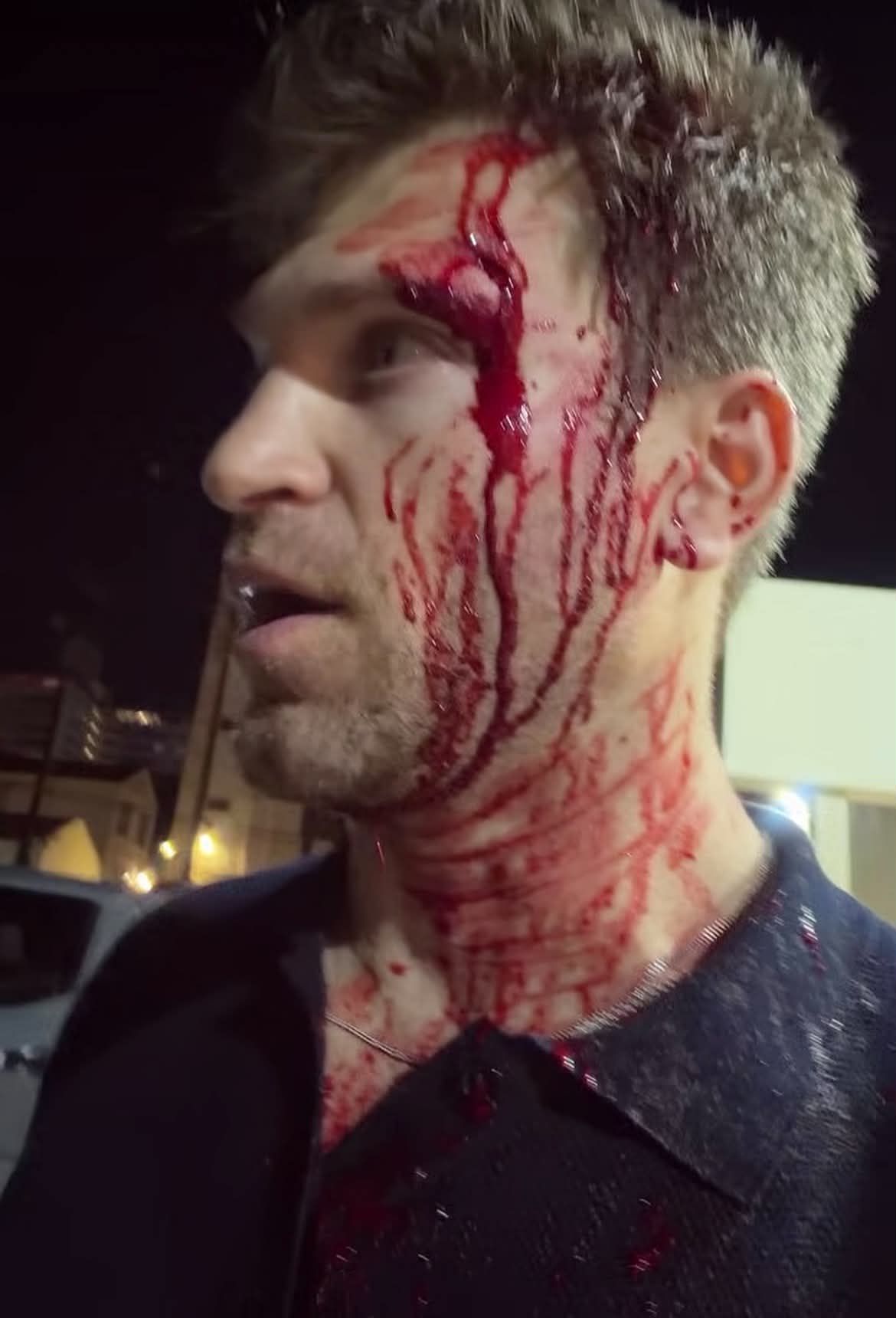 Keegan Allen komoly sérülést szenvedett a támadás során.