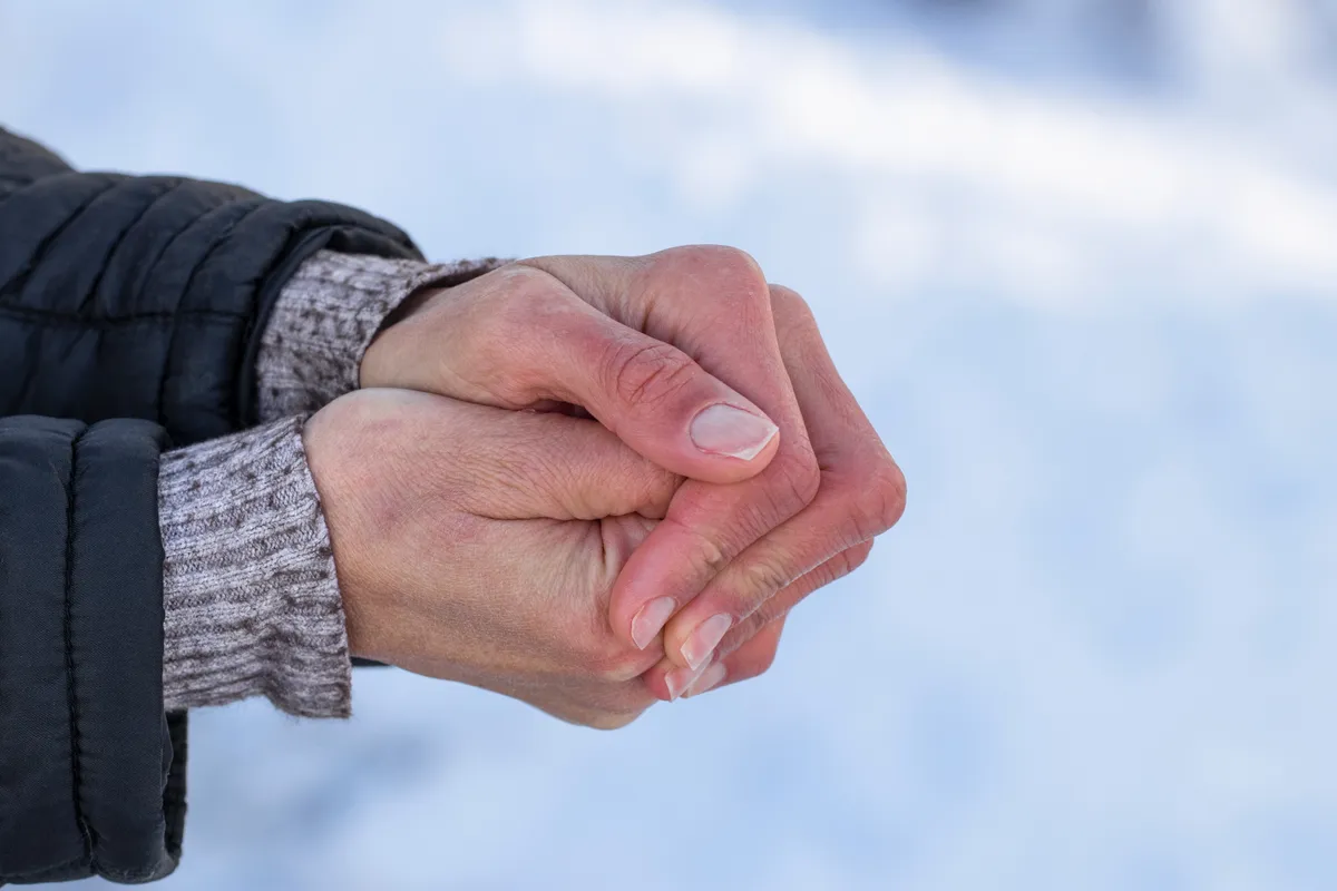 raynaud-szindróma