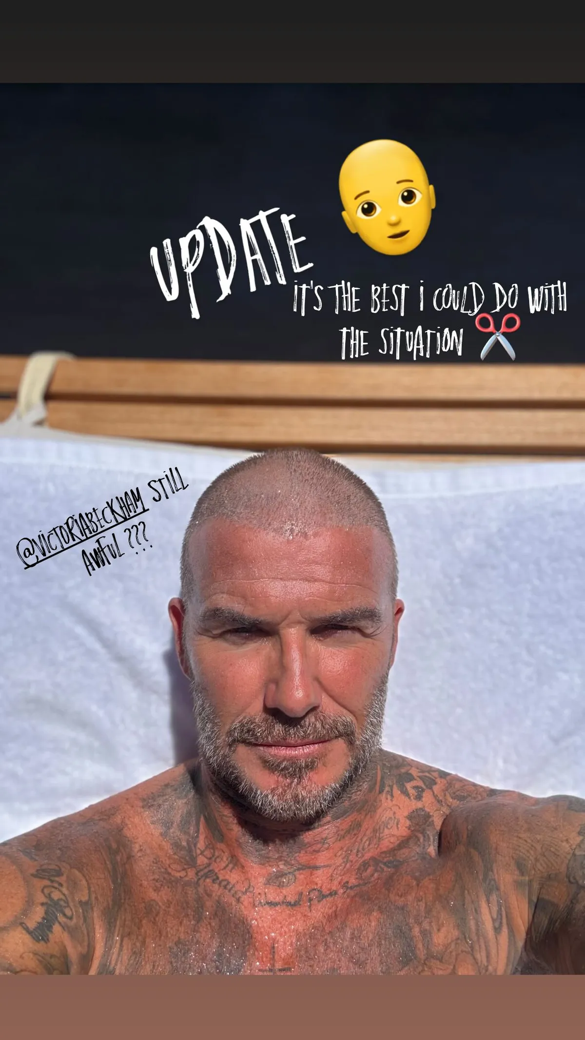 David Beckham egészen rövidre vágta a haját, de a kopasz folt még mindig látszik kicsit